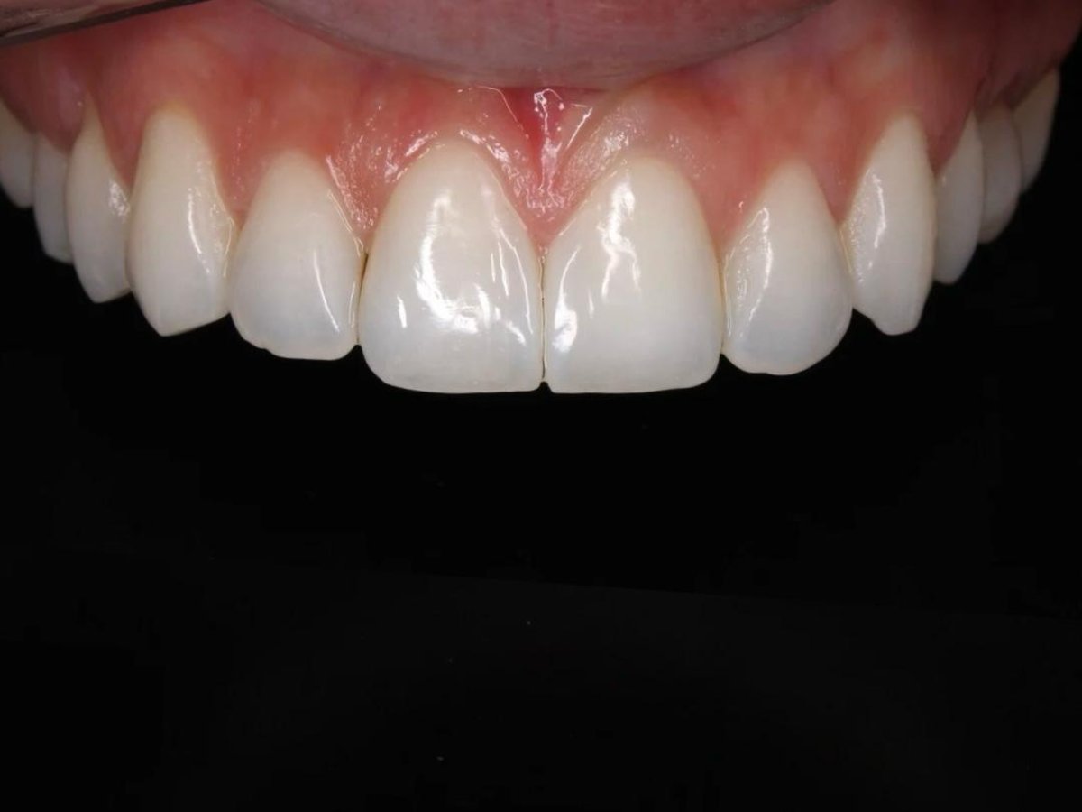 Odontologia Estética